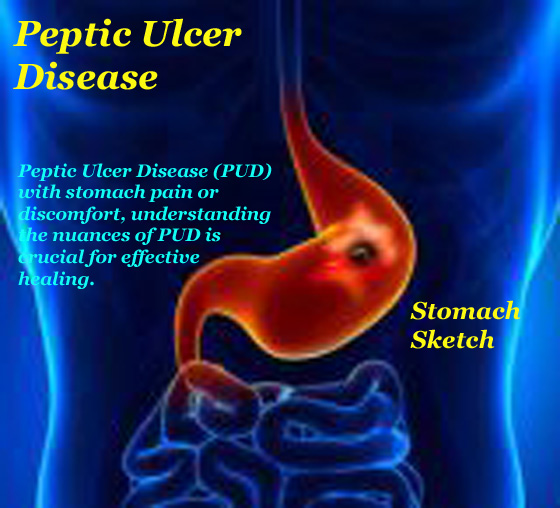 Stomack sketch with Peptic Ulcer Disease