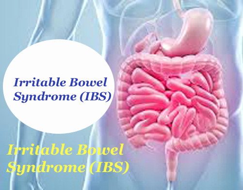 Irritable Bowel Syndrome (IBS) – 
