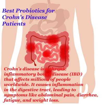 Structure Probiotics for Crohn’s Disease Patients