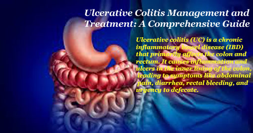Structure Ulcerative Colitis 